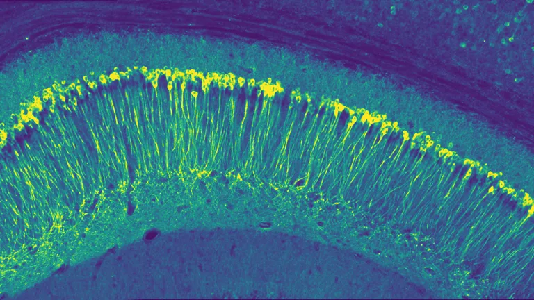 iPSC_derived neurons